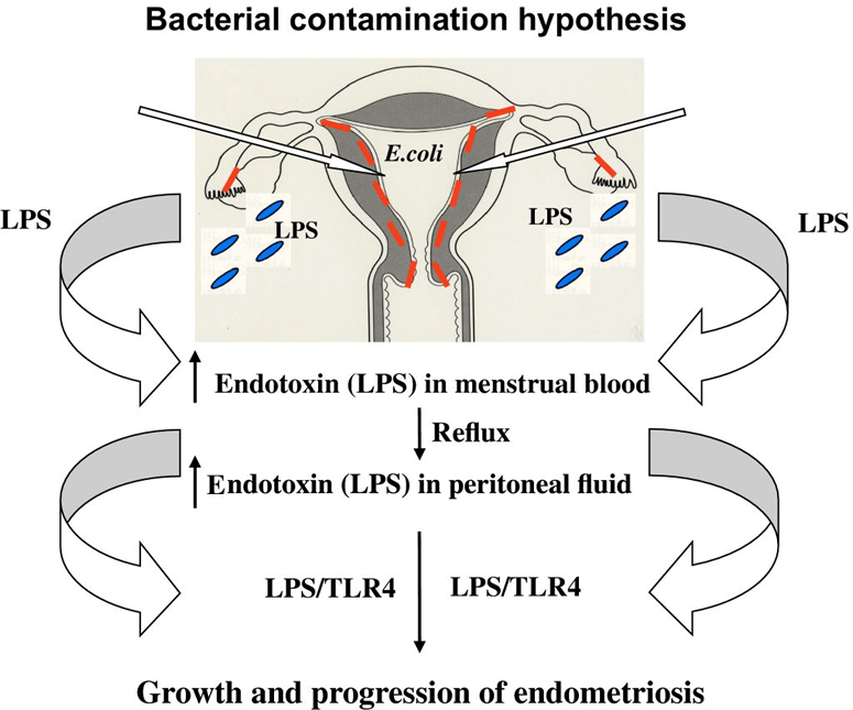 LPS-endometriosis