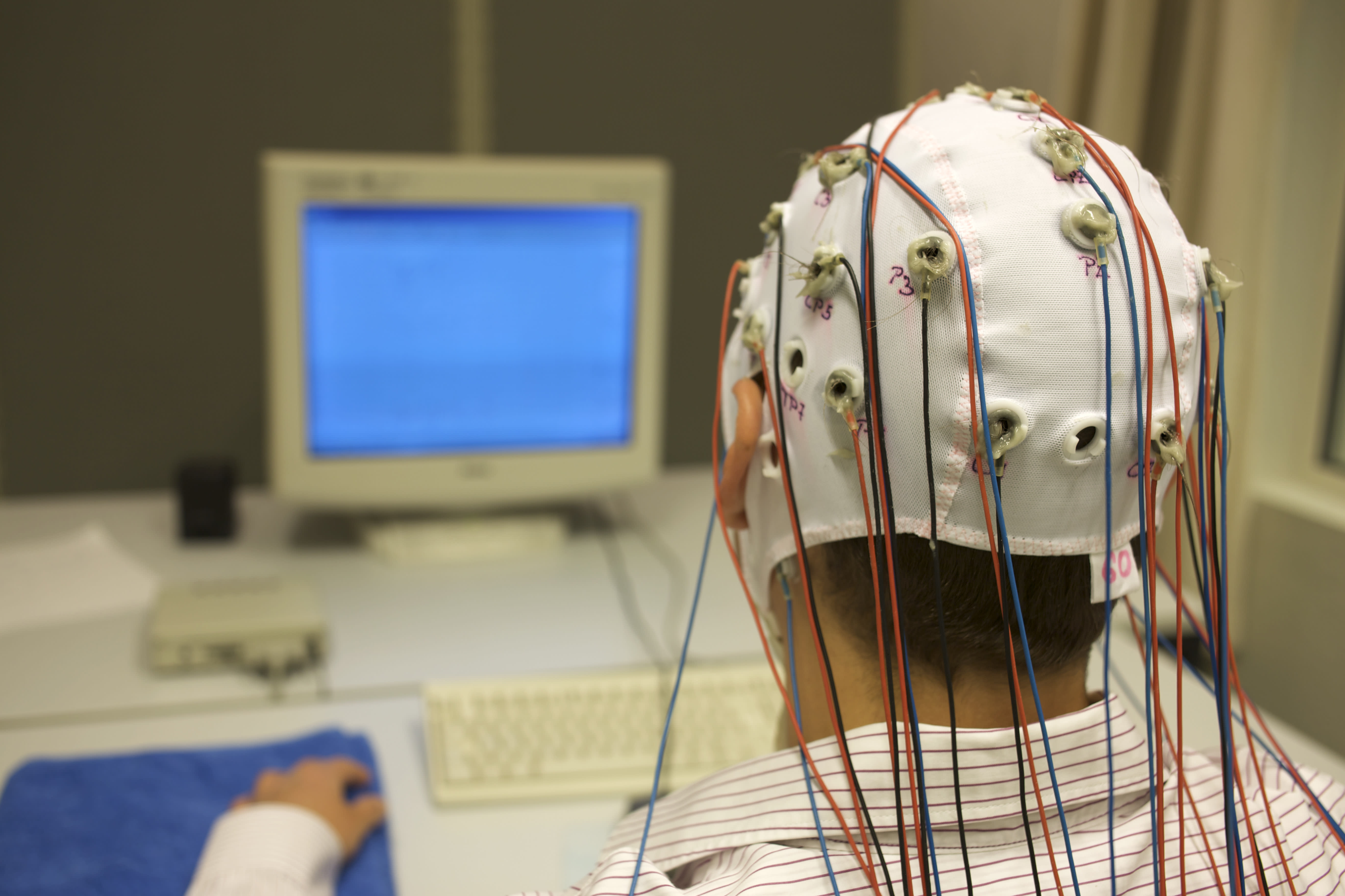 Нарушение биоэлектрической активности мозга. Энцефалография (ЭЭГ). Электроэнцефалография головного мозга (ЭЭГ). Электроэнцефалограф Air-EEG. Бос электроды ЭЭГ.