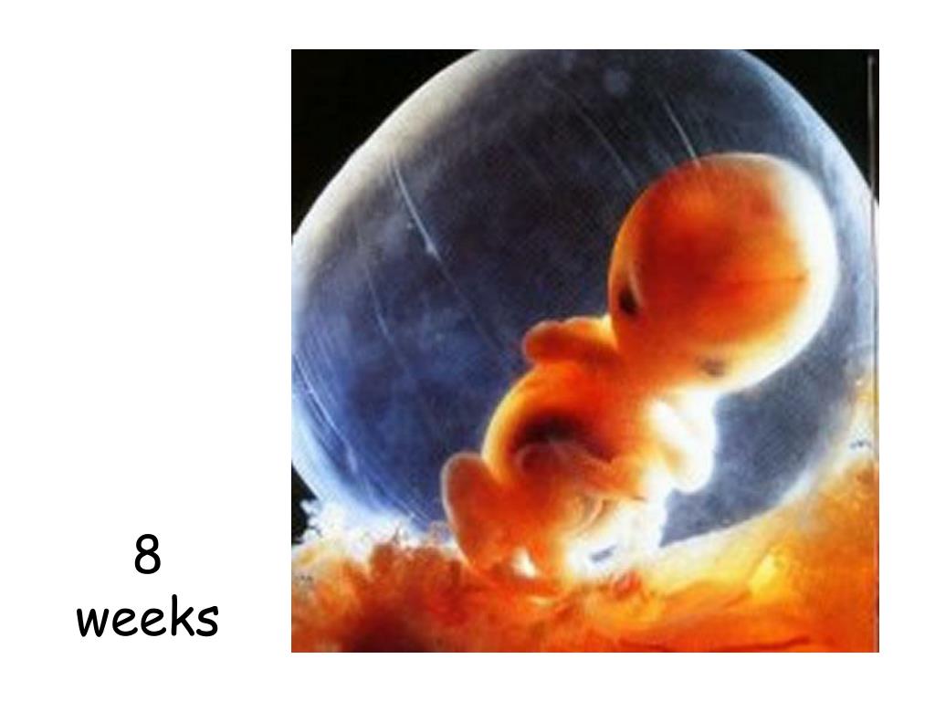 Роды на 8 неделе