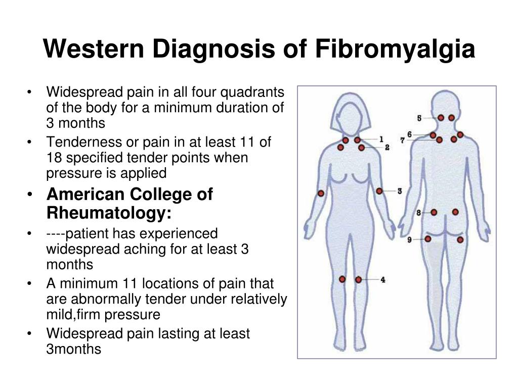 Болезненные точки при фибромиалгии фото
