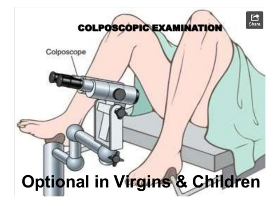 Вульвоскопия это. Что такое кольпоскопия в гинекологии. Исследование матки под микроскопом. Осмотр матки под микроскопом.