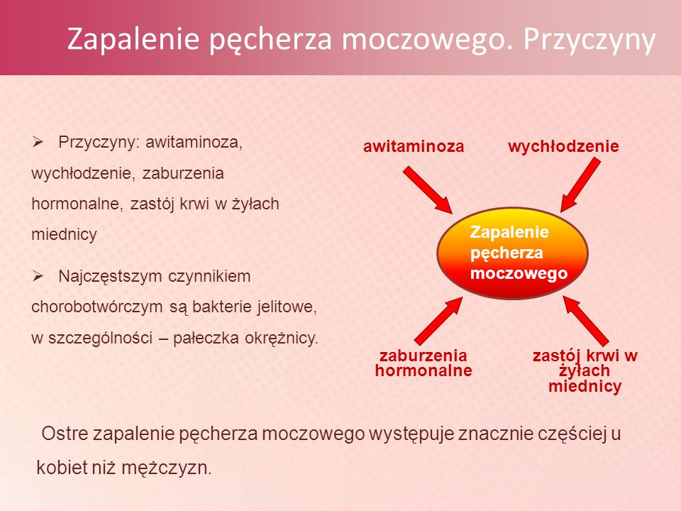 Схема лечения почек и мочевого пузыря у женщин