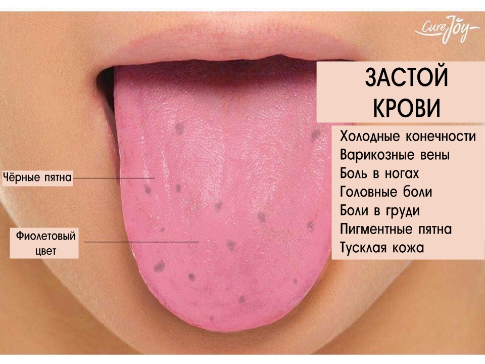 Географический язык фото у детей