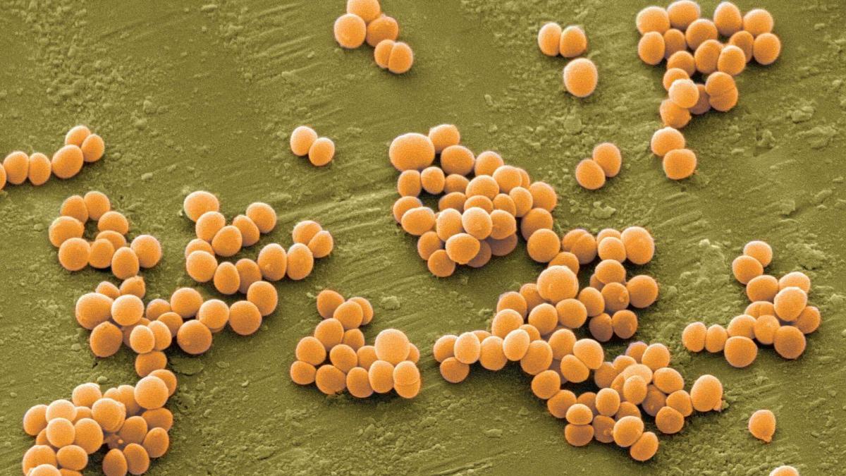 Бактерии staphylococcus aureus. Сапрофитный стафилококк. Золотистый стафилококк анаэроб. Стафилококк сапрофитный микроскопом.