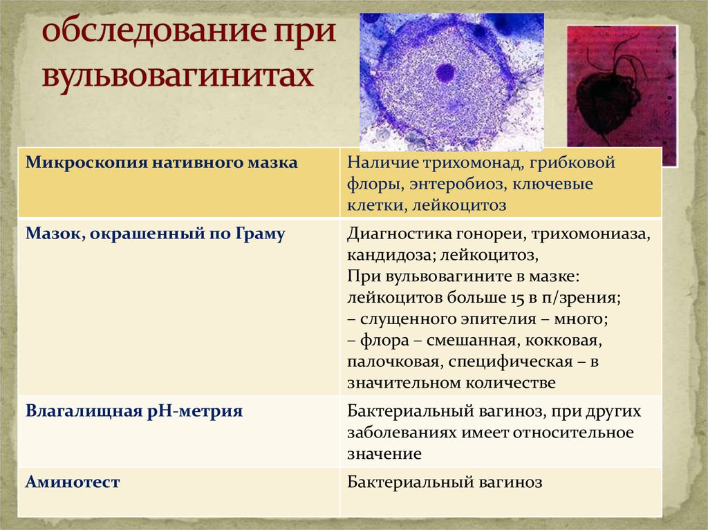 Вульвовагинит. Вагиниты, вульвиты, вульвовагиниты. План обследования при вульвовагините. Бактериальный вагиноз лейкоциты.