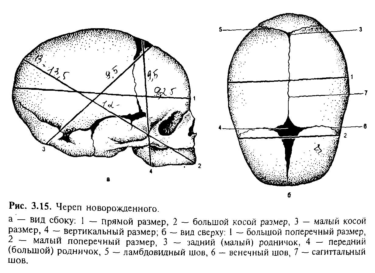 Стреловидный шов черепа новорожденного