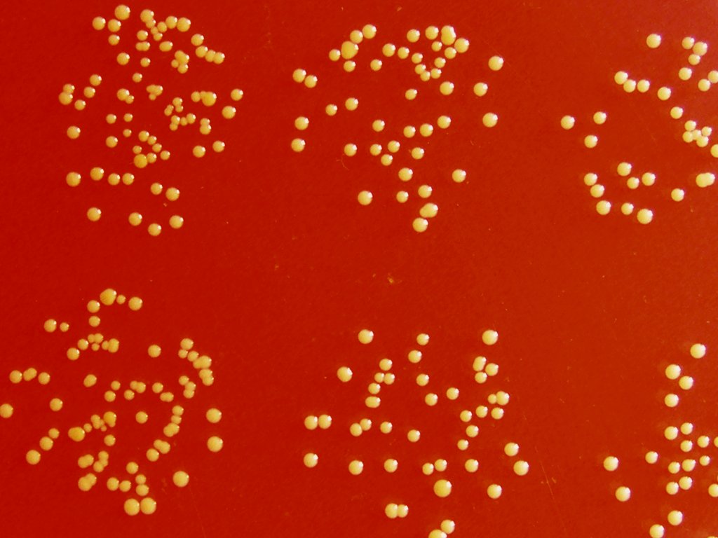 Staphylococcus aureus степени. Staphylococcus chromogenes. Staphylococcus aureus капсула. Золотистый стафилококк на коже. Стафилококк Варнери.