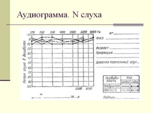 Нормальный слух. Аудиограмма слуха норма. Аудиометрия слуха норма таблица. Расшифровка аудиометрии слуха норма. Аудиограмма слуха расшифровка таблица норма.