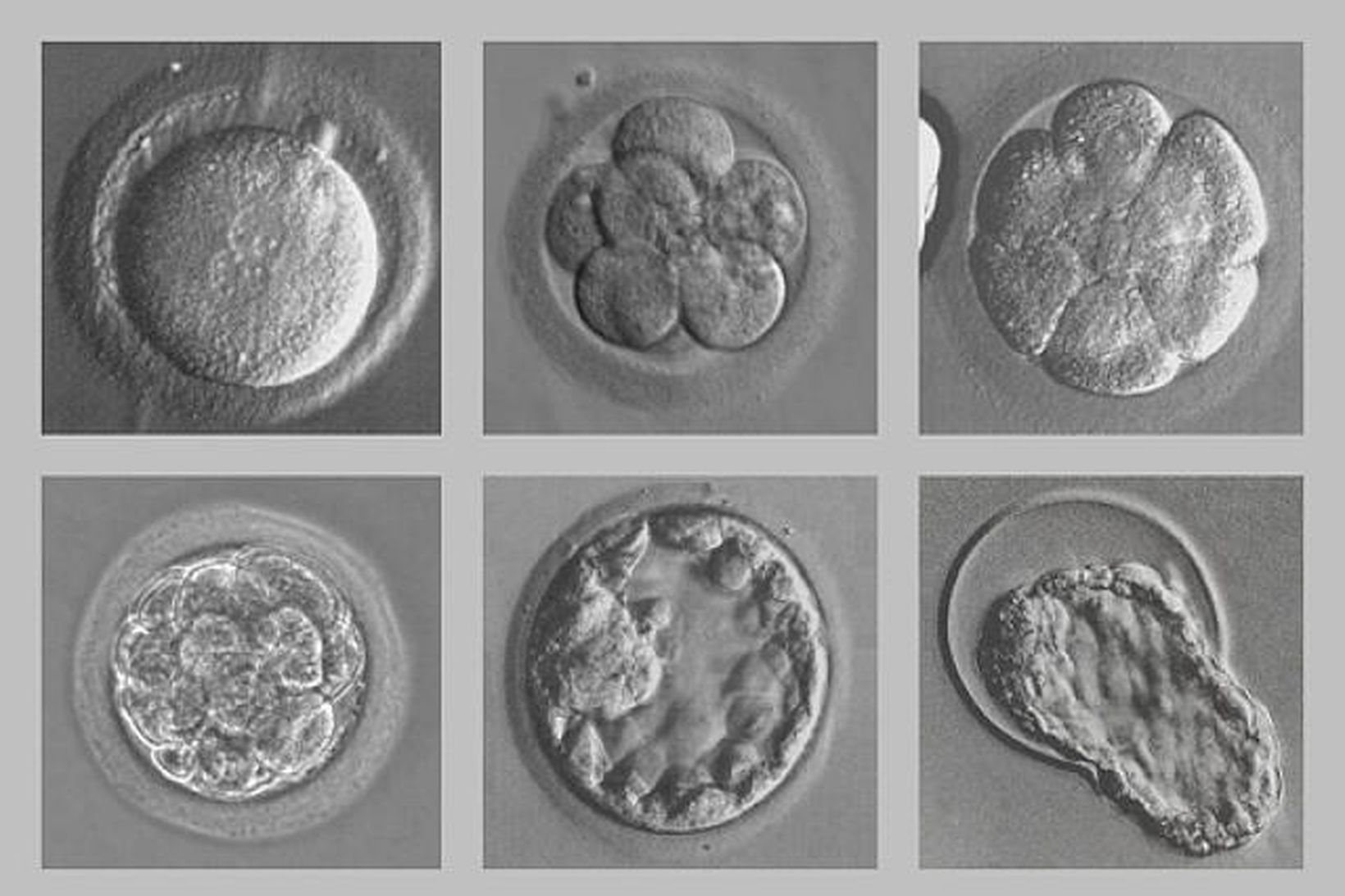 5 дневка эмбрион. Эмбрион бластоциста. Бластоциста клеточный эмбрион. Эмбрион бластоциста 2. Эко ИКСИ стадии развития эмбриона.