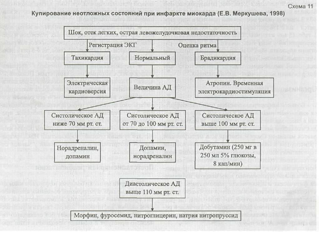 Медицинская помощь при инфаркте миокарда