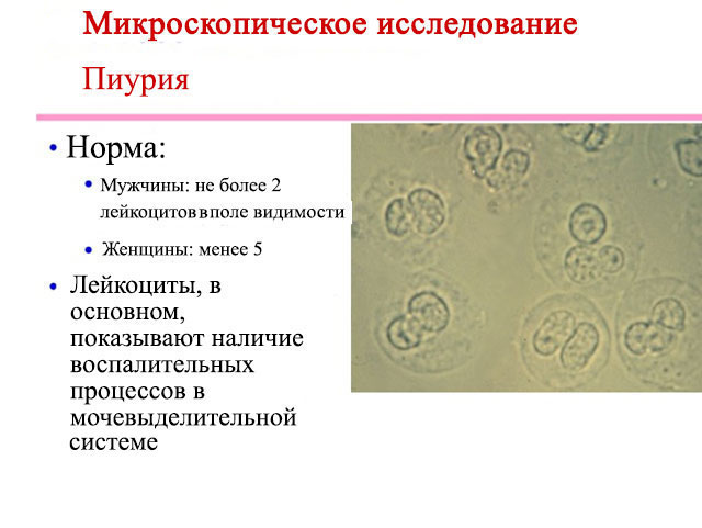 Норма лейкоцитов при пиурии