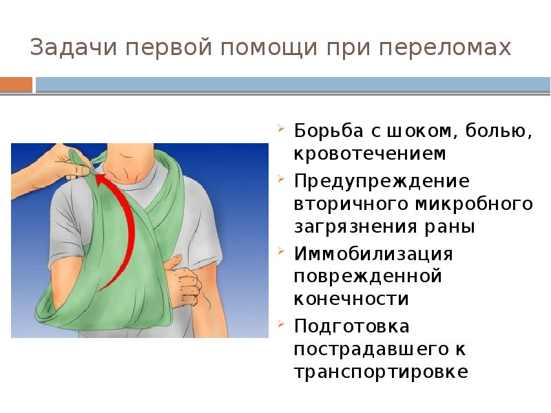 Первая помощь при переломах кровотечениях. Оказание помощи при переломе предплечья. Оказание первой помощи при переломе предплечья. Первая помощь при переломах. Оказание помощи при открытом переломе предплечья.