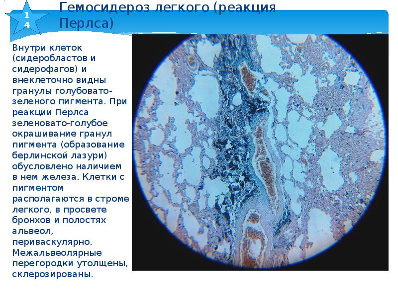 Реакция перлса