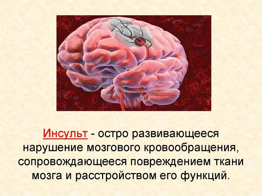 Имеет крови мозга и. Нарушение мозгового кровообращения. Нарушение кровообращения мозга. Ишемические нарушения мозгового кровообращения.