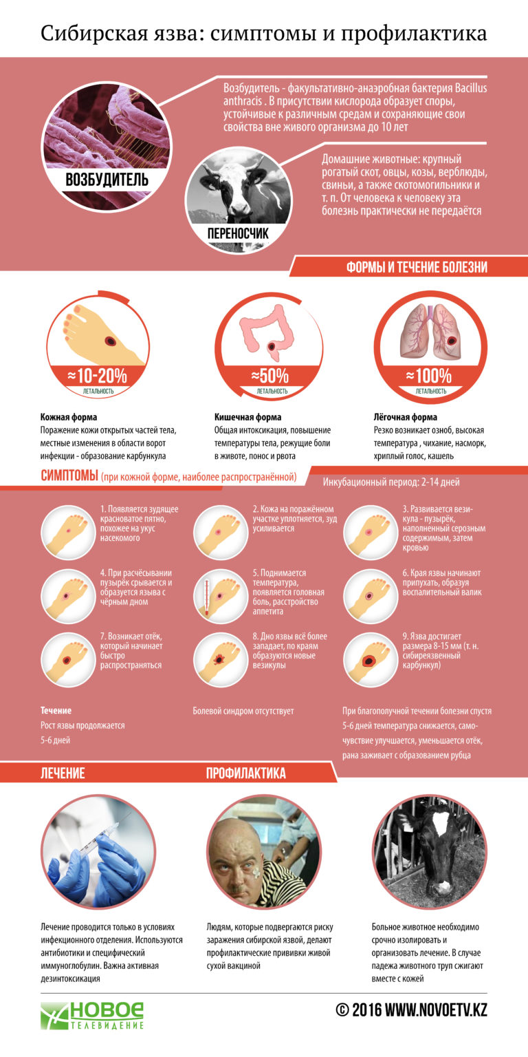 Сибирская язва симптомы у человека фото
