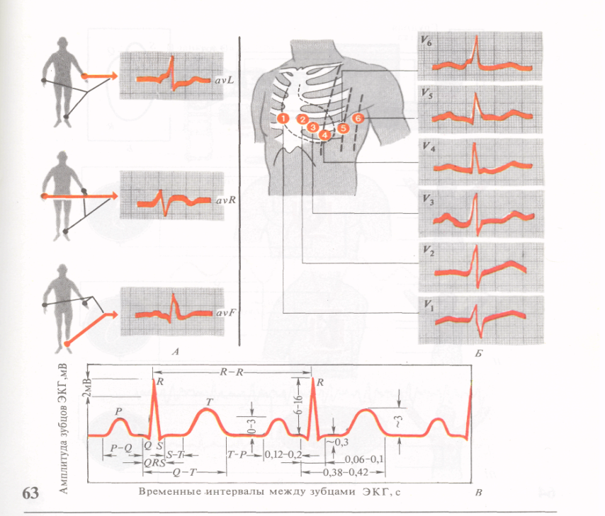 Кардиограмма расшифровка