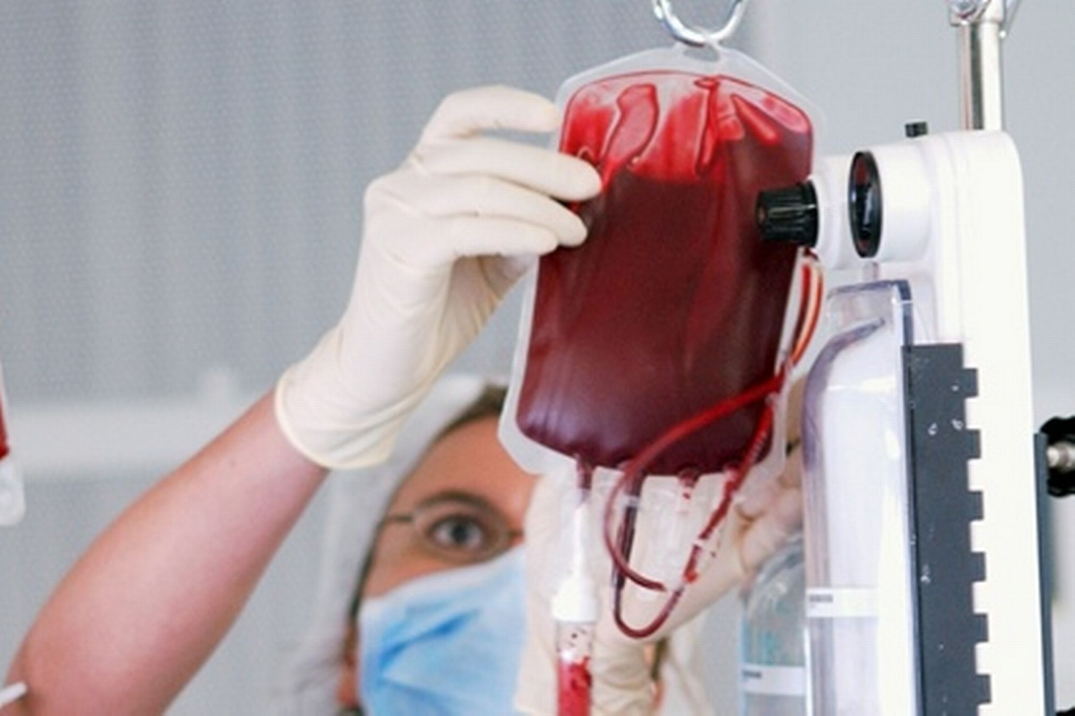 Операция заменного переливания крови (ОЗПК)