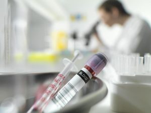 Результаты анализов могут подтвердить или опровергнуть наличие онкологии
