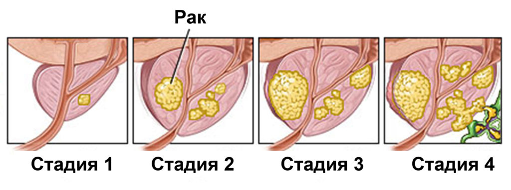 Простата