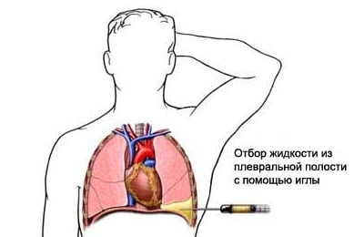 Проведение процедуры