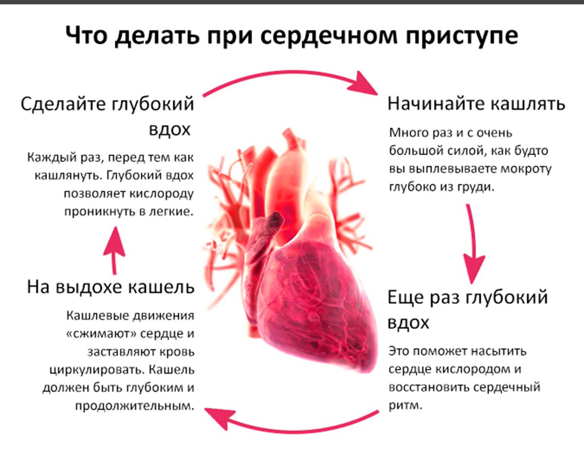 Какие симптомы проблем с сердцем. Что сделать КСЛИ уолит сеплцею. Что слелать если болит сердце. Сердечный приступ.