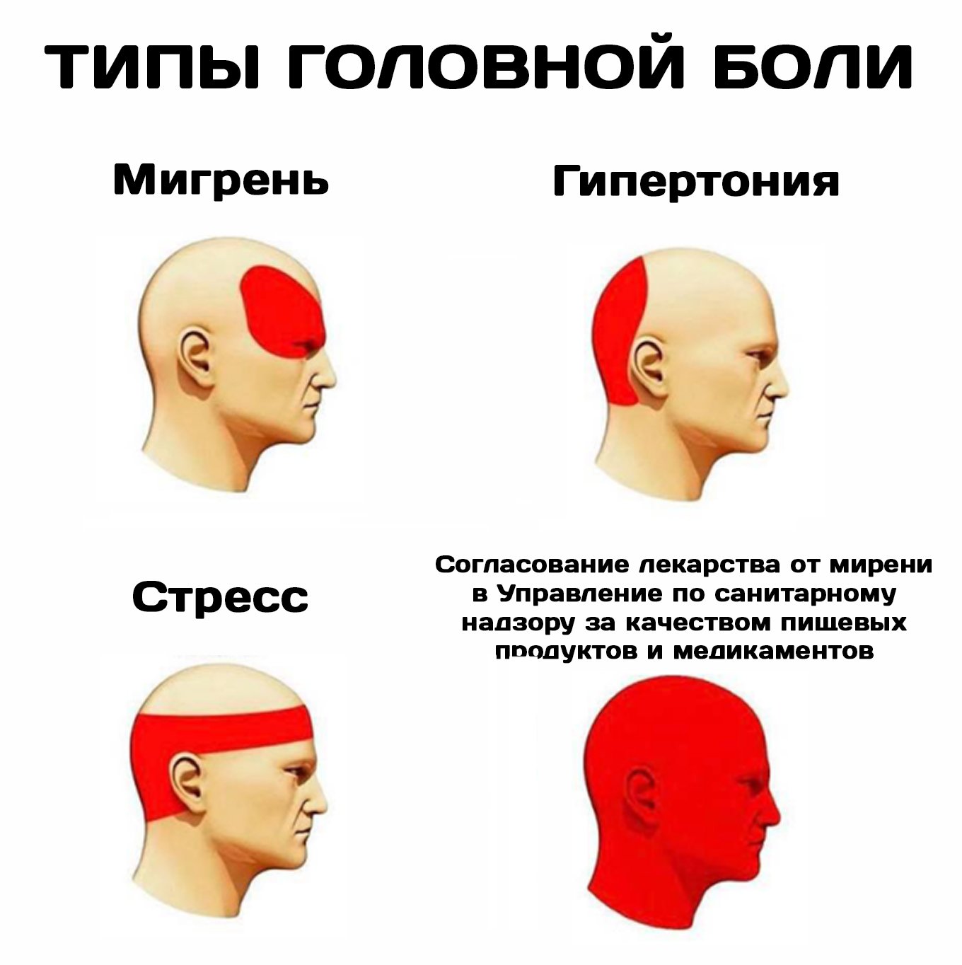 Виды головных болей в картинках