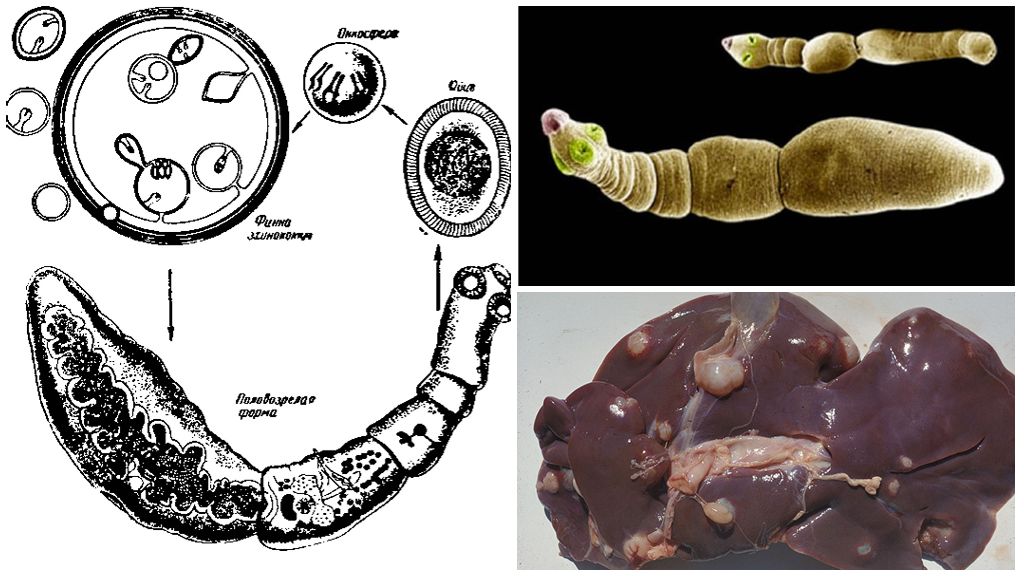 Что значит эхинококк