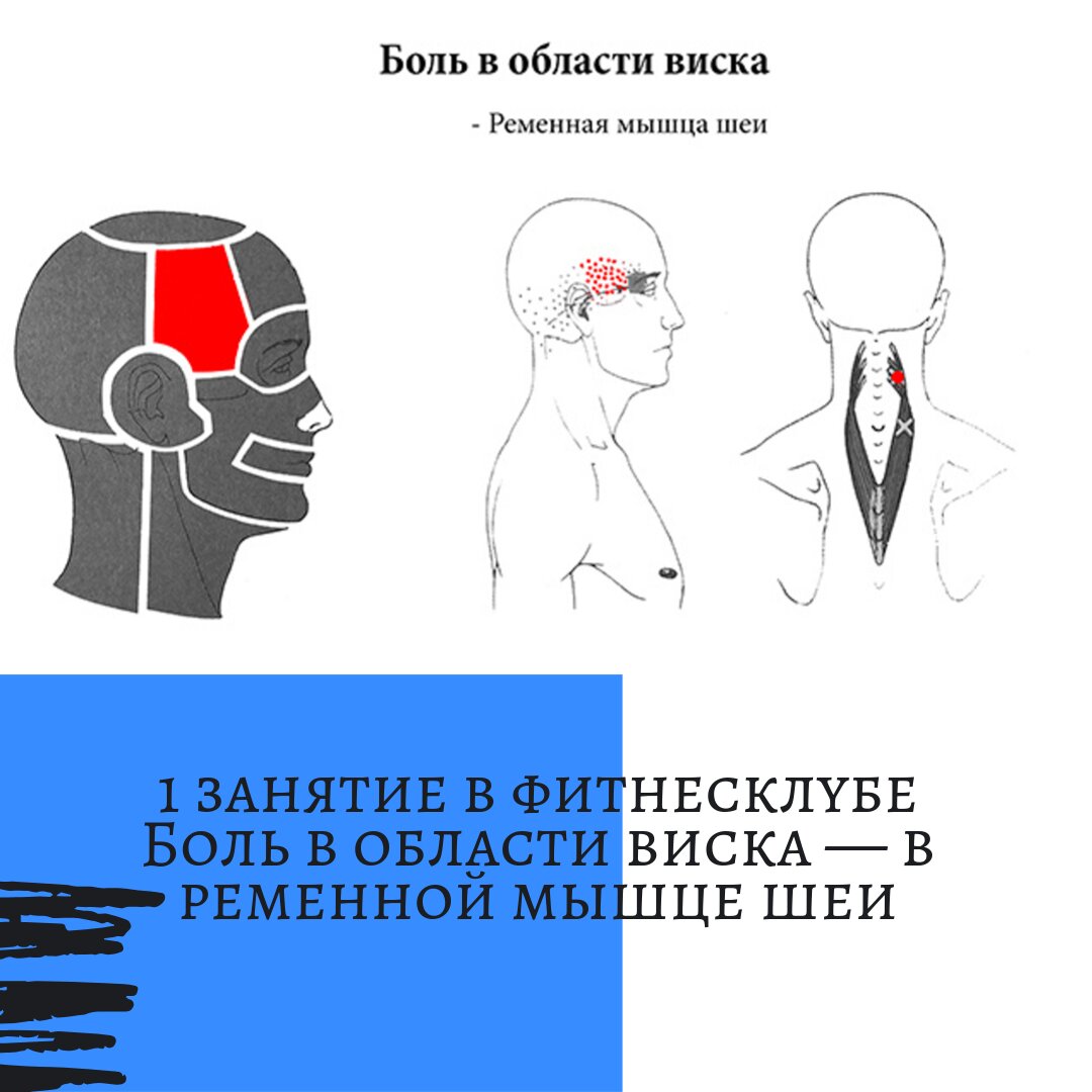 Постоянные головные боли. Головная юоль в вичках. Болит в висках. Болит голова в Виске.