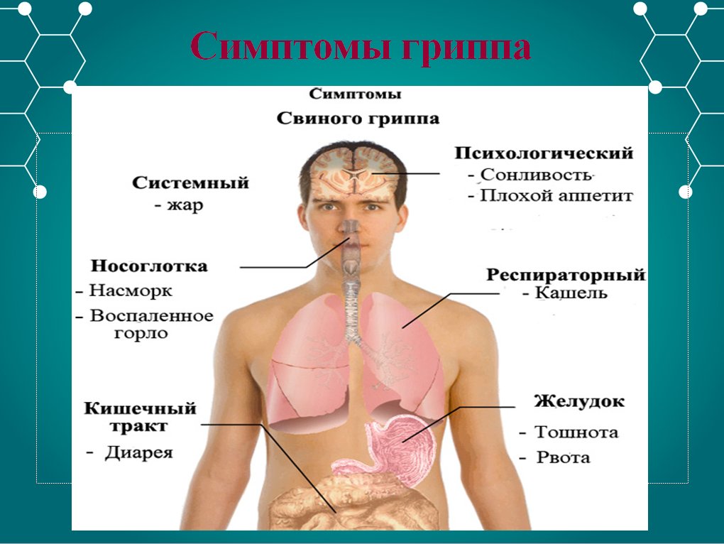 Проявления гриппа. Симптомы гриппа. Признаки гриппа. Основные симптомы гриппа. Типичные симптомы гриппа.