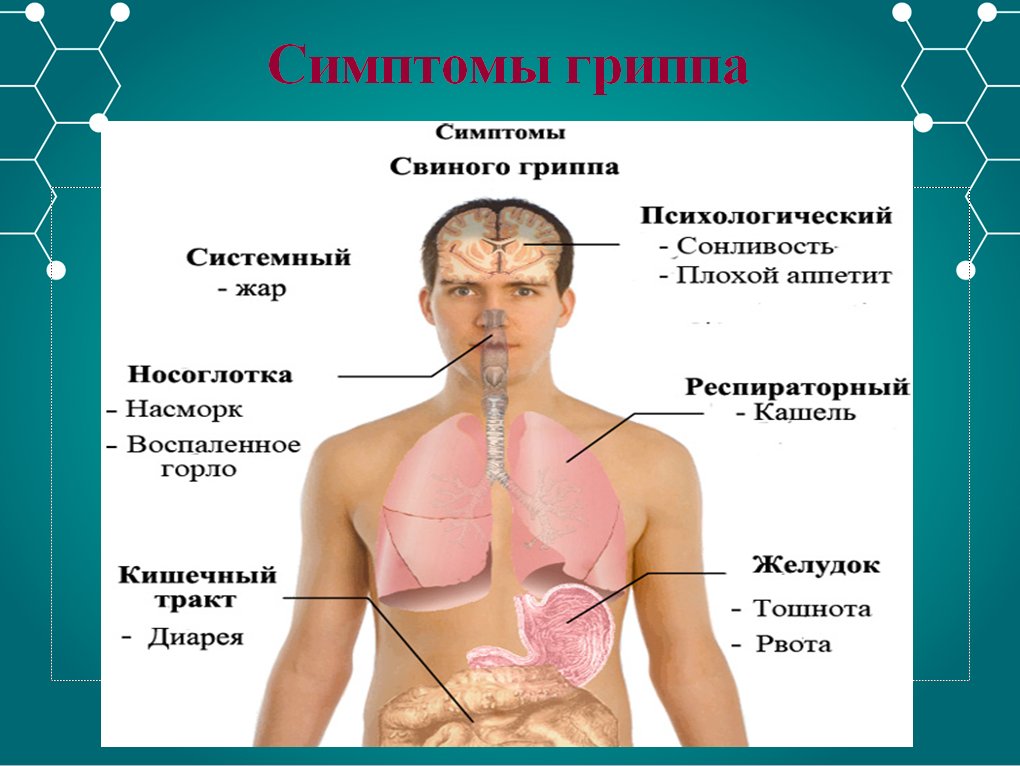 Грипп признаки. Симптомы гриппа. Признаки гриппа. Симптоматика гриппа. Симптом характерный для гриппа.