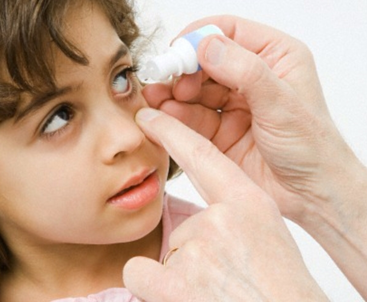 Коньюктивит у ребенка 6 лет. Закапывание в глаза ребенку. Аллергические глаза у детей. Аллергические заболевания глаз у детей.