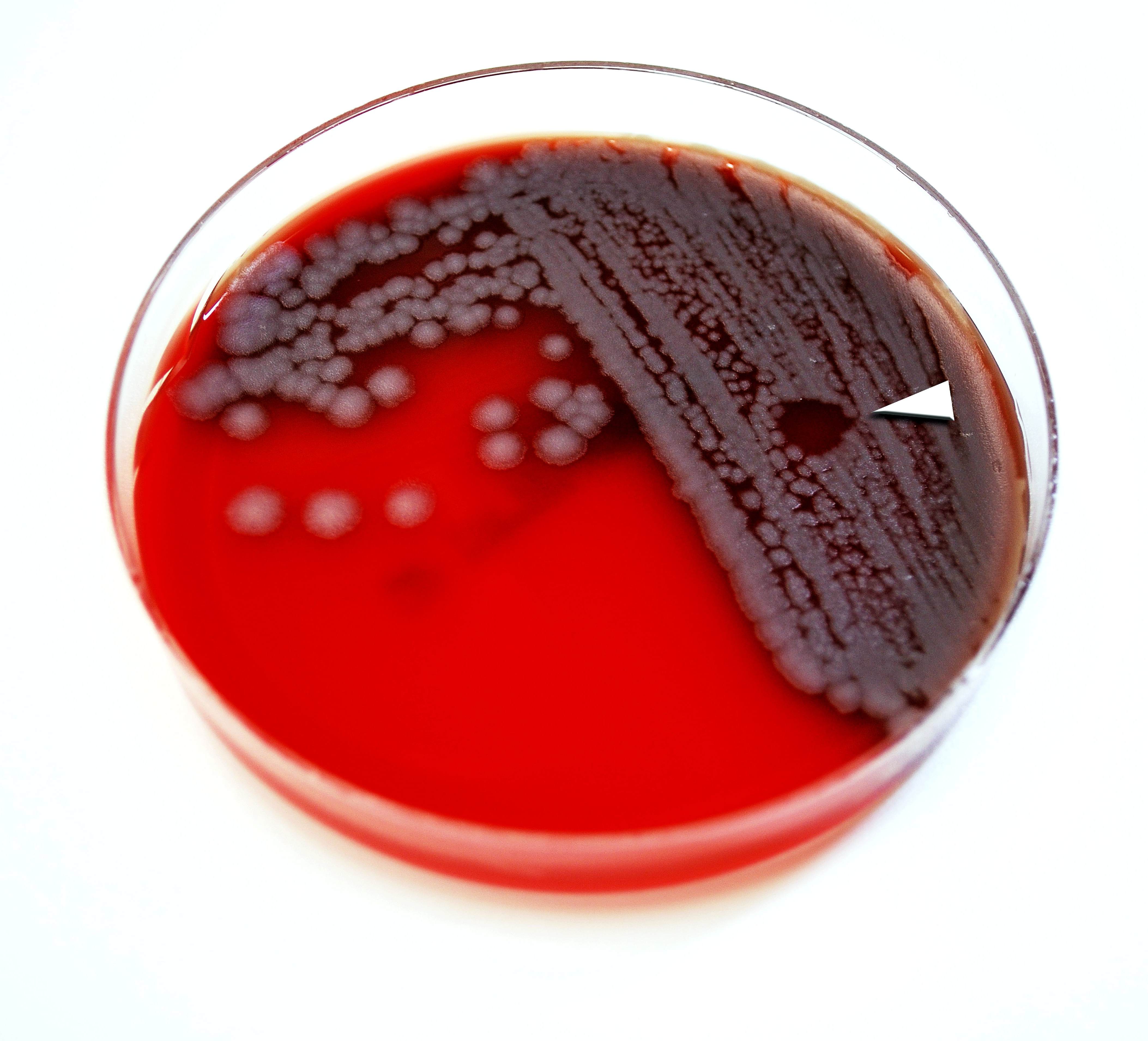 Легочная язва. Bacillus anthracis, а22 (Сибирская язва). Bacillus anthracis на кровяном агаре. Бактериоскопия сибирской язвы.