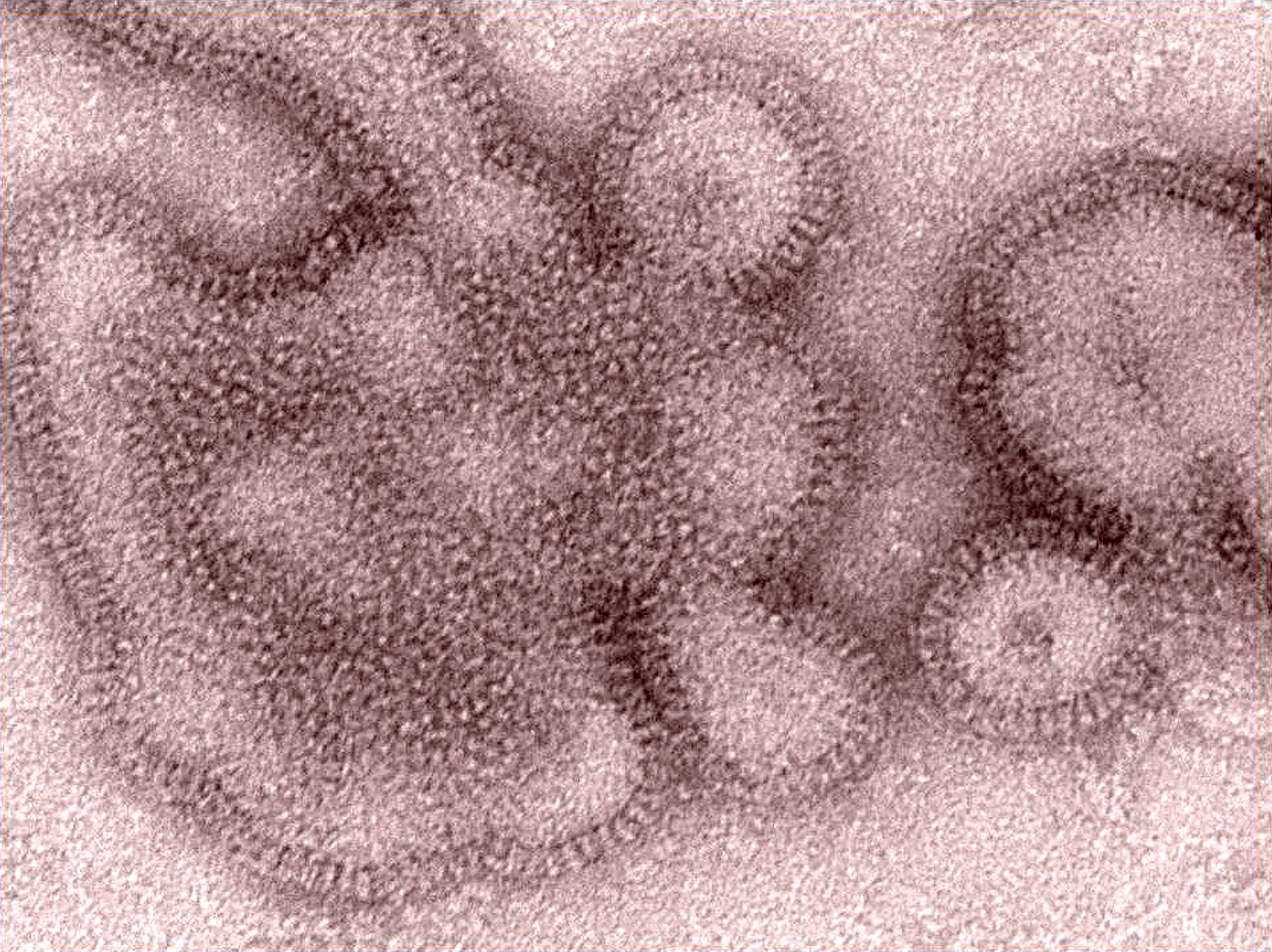 Вирус гриппа под. Вирус h3n2. Вирус гриппа h3n2. Вирус h1n1 испанка под микроскопом. H3n2 гонконгский грипп.