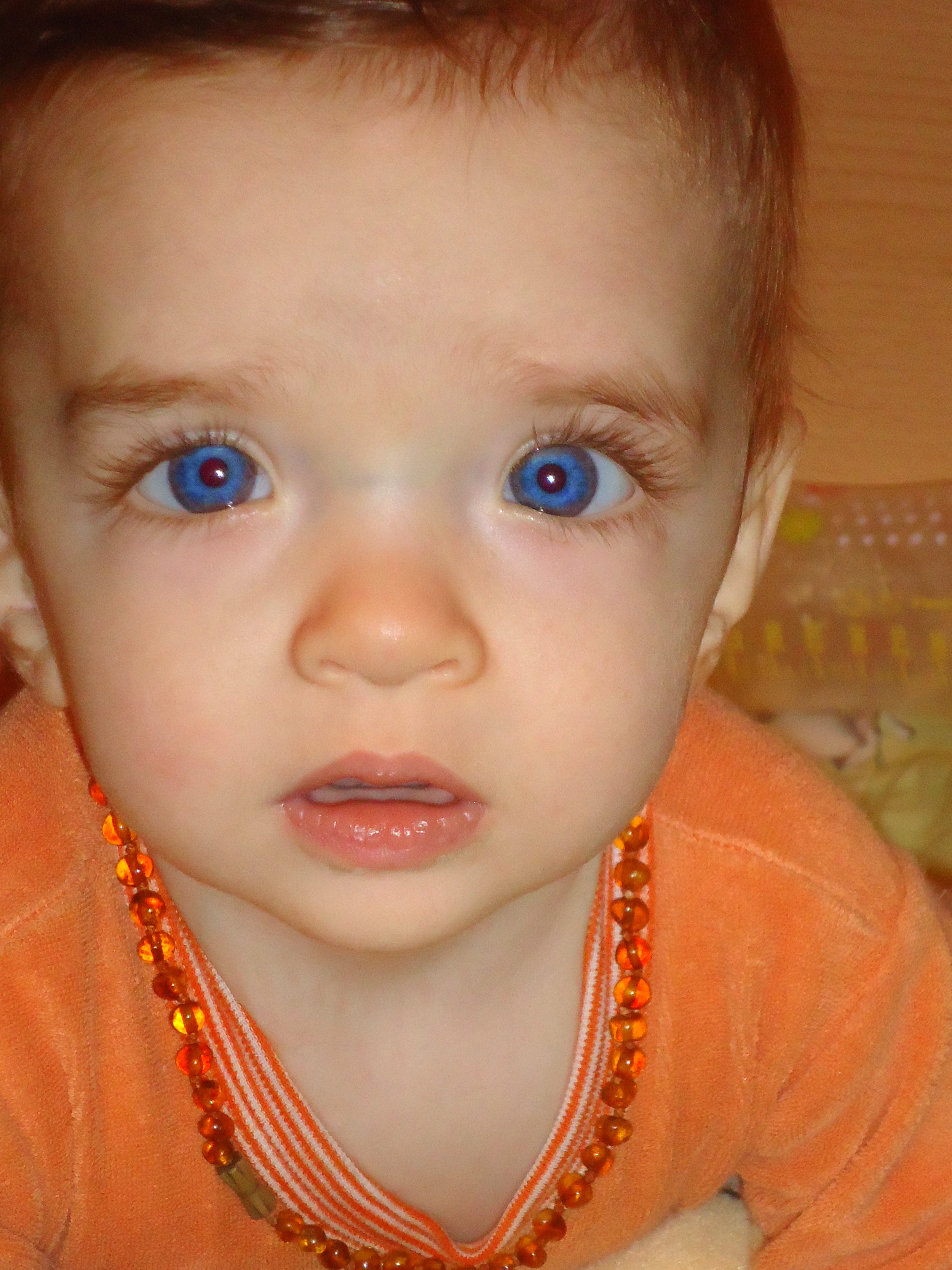 Почему ребенок оранжевый. Глаза ребенка. Синяя переносица у ребенка. Дети с синими глазами. Широкая переносица у ребенка.