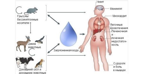 рисунок схемы заражения человека лептоспирозом