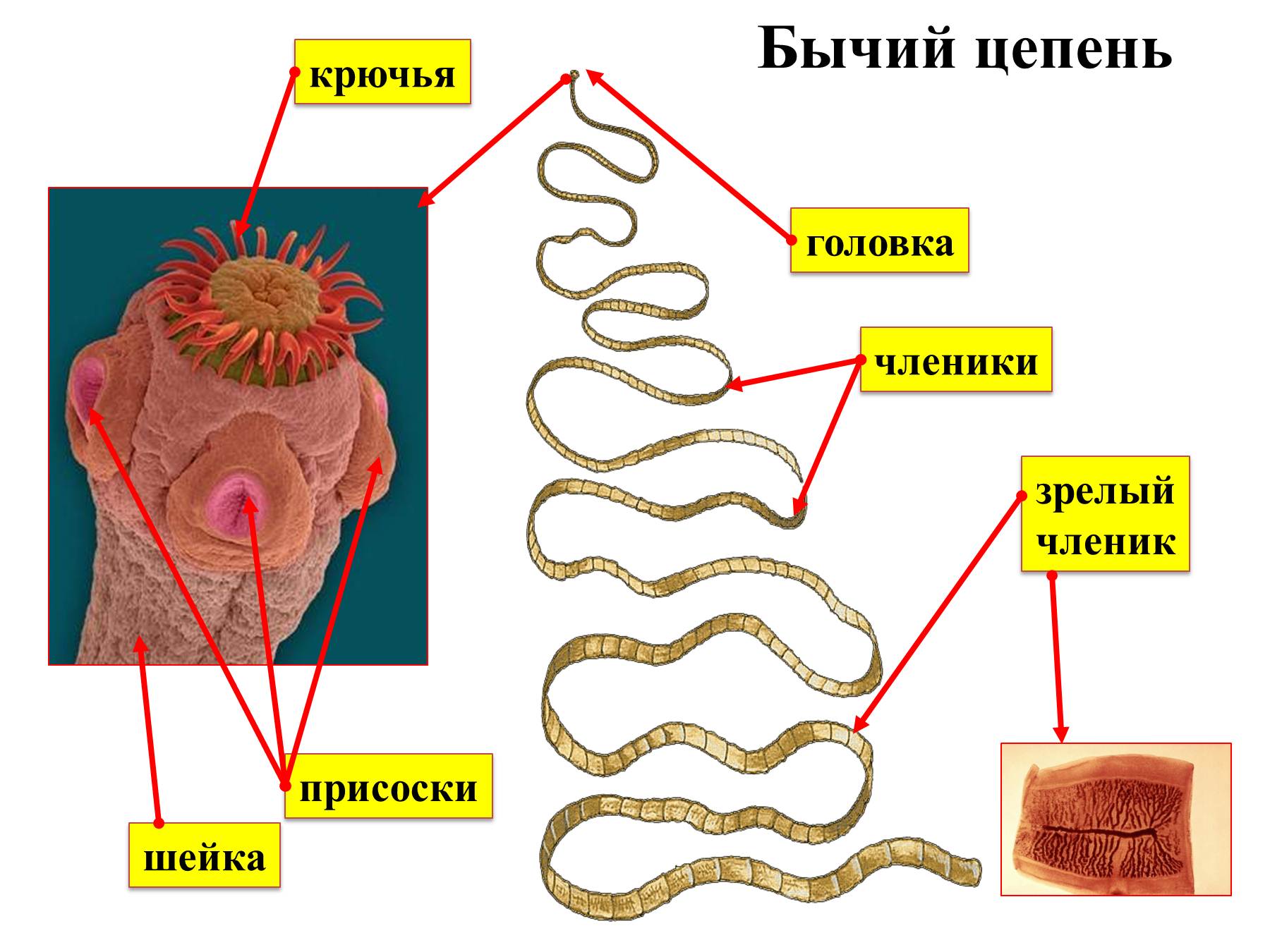 В каких органах паразитирует бычий цепень. Паразитические ленточные черви строение. Taeniarhynchus saginatus бычий цепень. Строение ленточных червей паразитов. Паразитические черви гельминты строение.
