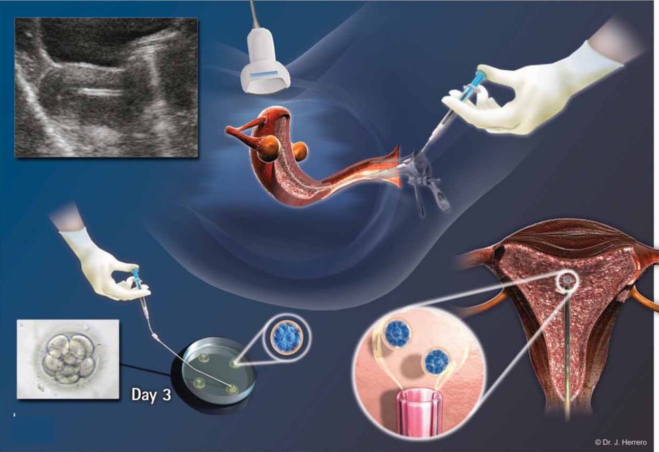 эмбрион на 7 день после переноса