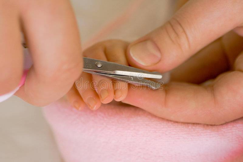 Как подстричь новорожденного. Стрижка ногтей новорожденному. Стрижка ногтей на ногах у новорожденного. Стричь ногти новорожденному. Как правильно стричь ногти новорожденному.
