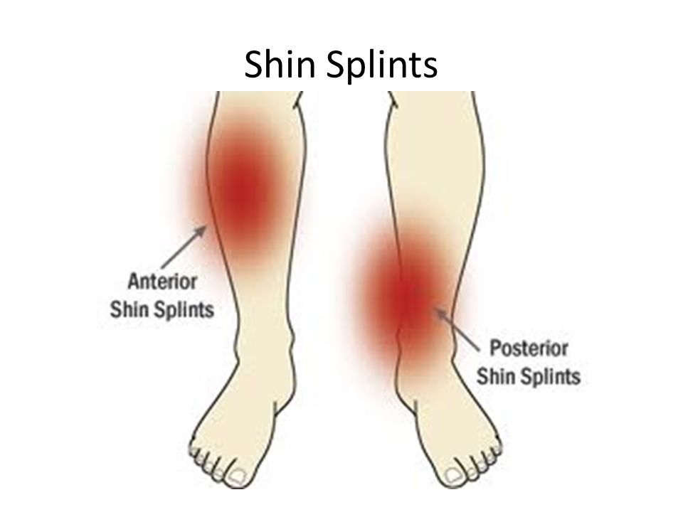 Ноющая боль в ногах ниже. Ноющая боль в голени спереди. Болит голень ноги спереди ниже колена.