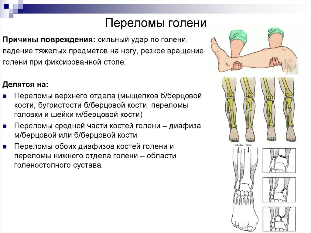 Травмы верхних и нижних конечностей презентация