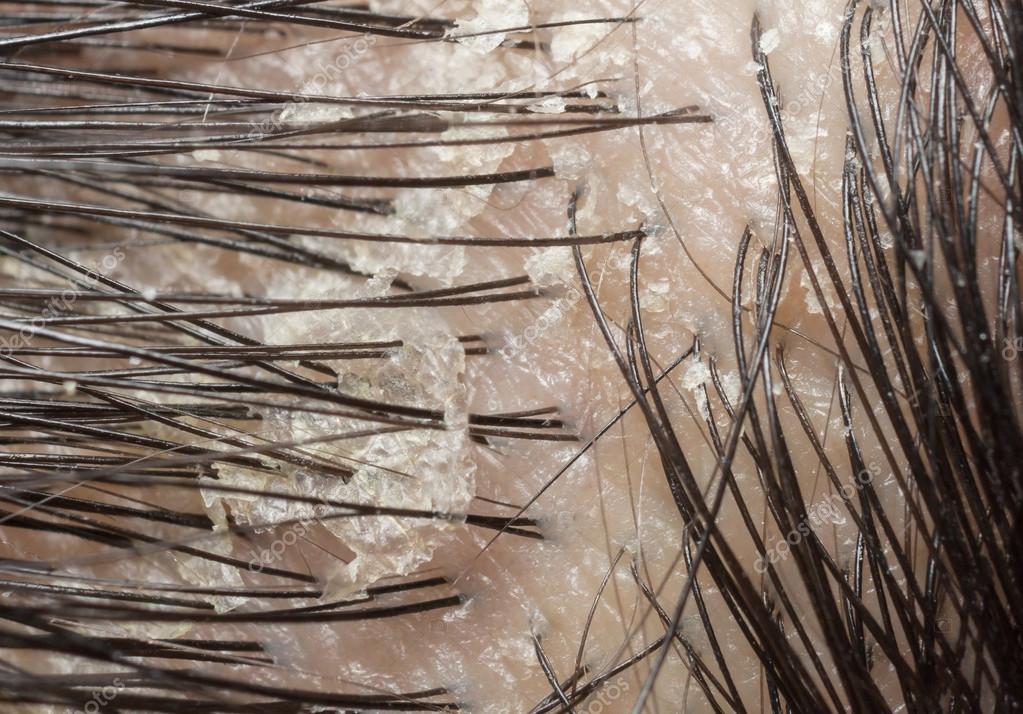 Можно ли повредить луковицы волос у новорожденных
