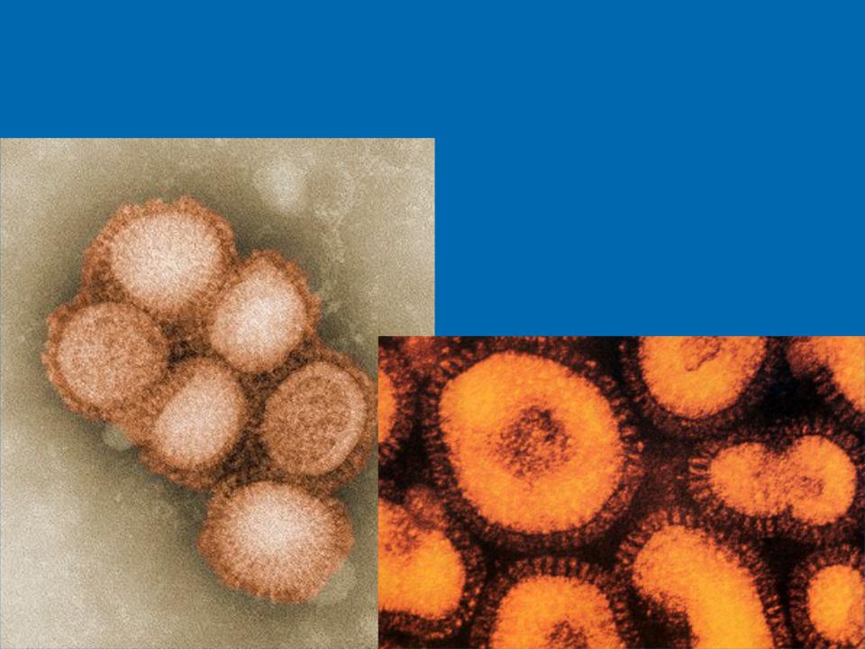 Вирус гриппа под. Вирус гриппа h1n1. Вирус h1n1 под микроскопом. H1n1 — серотип вируса гриппа а. Структура вируса гриппа электронная микроскопия.