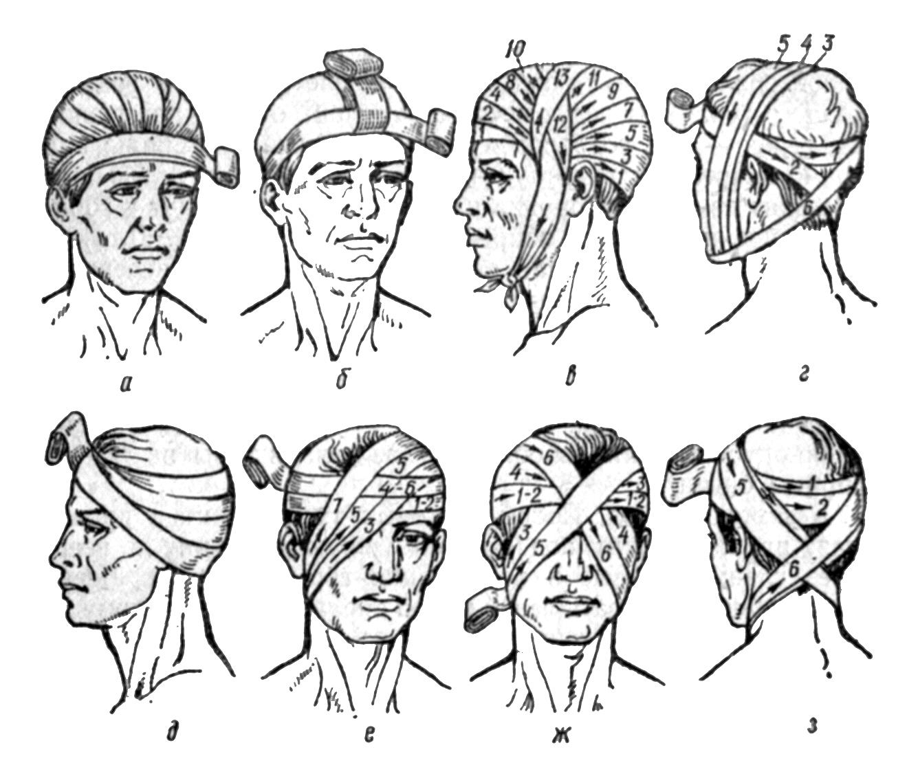 Порядок наложения повязки при ранениях головы туловища верхних и нижних конечностей презентация