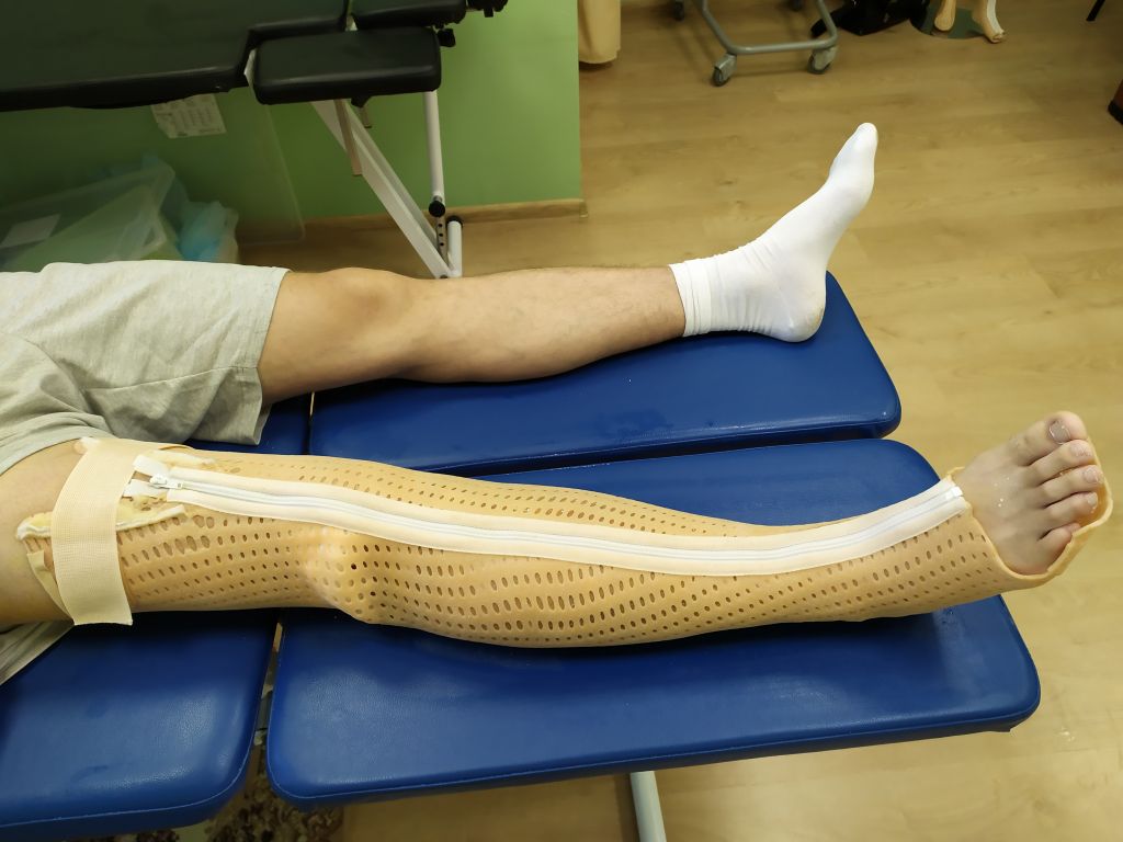 Ортопедическая операция ног
