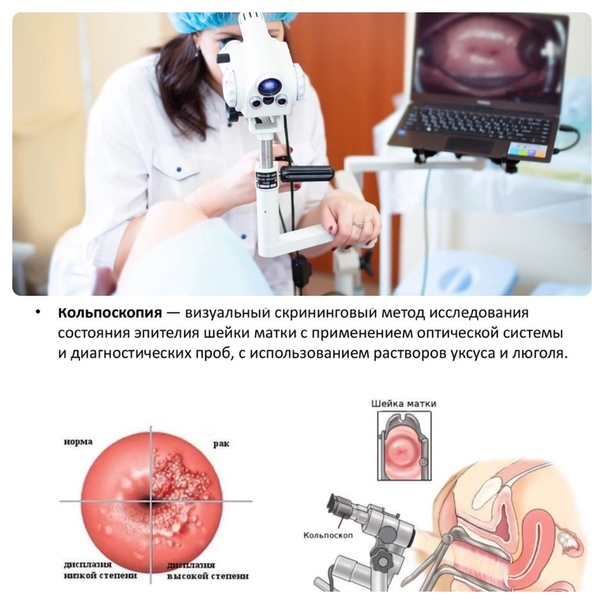 Аномальная кольпоскопическая картина 1 степени что это значит у женщин