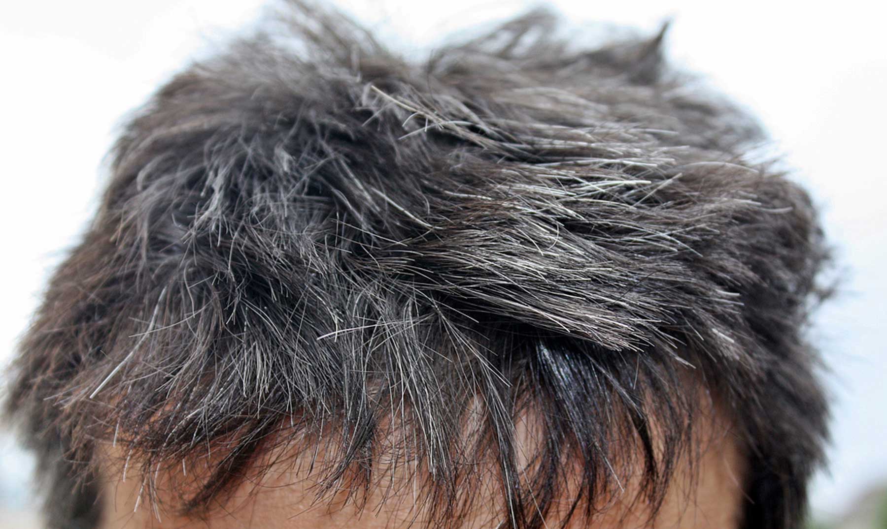 Появляются черные волосы на седой голове