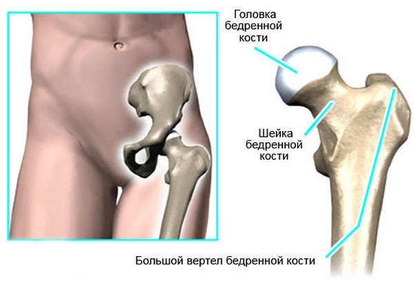 Вертелы бедренной кости