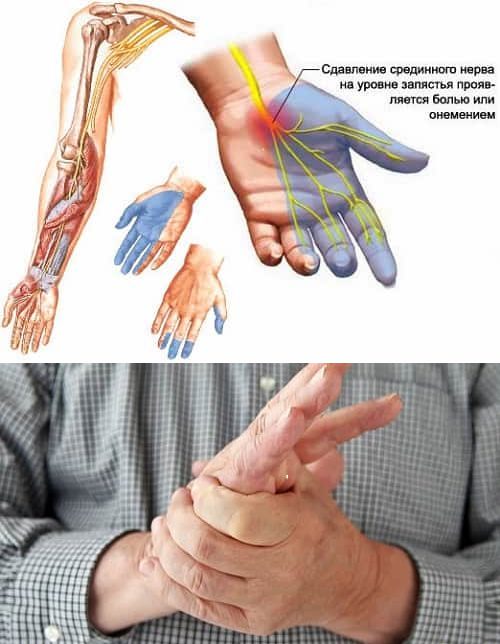 Почему пальцы на руке сами дергаются