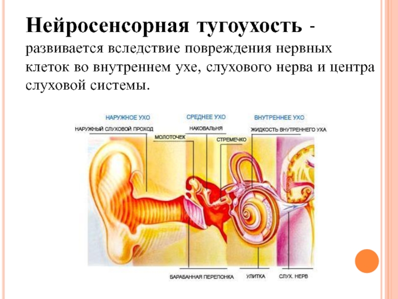 Тугоухость что это. Механизм развития нейросенсорной тугоухости:. Нейросенсорная тугоухость симптомы. Тугоухость ослабление слуховой функции. Внезапная нейросенсорная тугоухость и глухота.