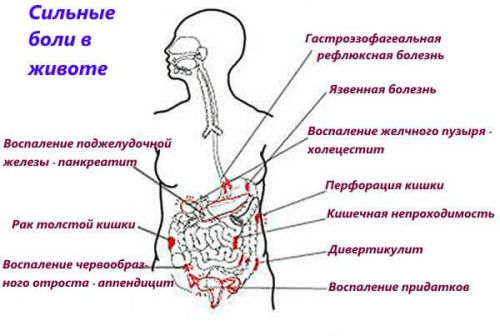 Боли в животе